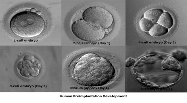 embryo-blastocyst-culture-in-sai-ivf-jabalpur